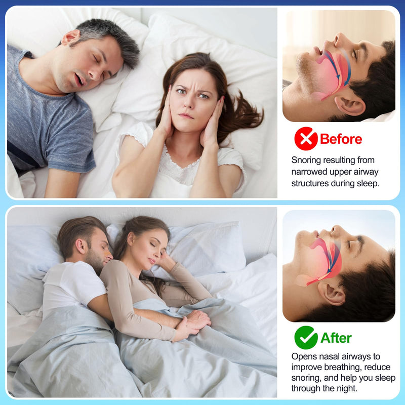 [Australia] - Nasal Strips for Snoring, Nose Strips for Breathing, Anti Snoring Devices for Sports and Sleep, Help Relieve Nasal Congestion, Stop Snoring, Breathing Smoothly, Sleep Soundly, TAN, 50 Count 