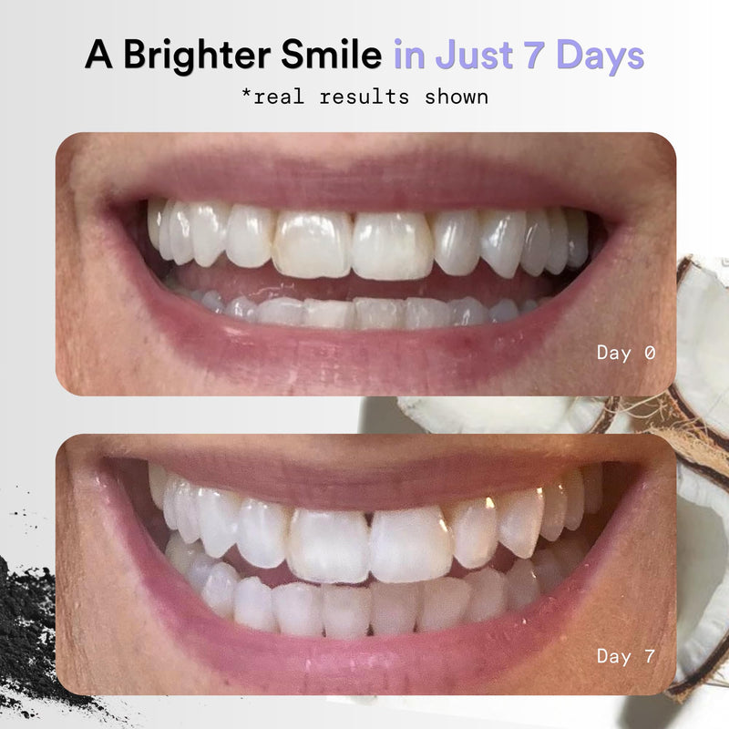 Charcoal Teeth Whitening Strips, Non-Slip, 14ct | Bamboo Charcoal & Coconut Oil gently lift surface stains. Peroxide-Free, Fresh Mint Flavor, 14 Treatments