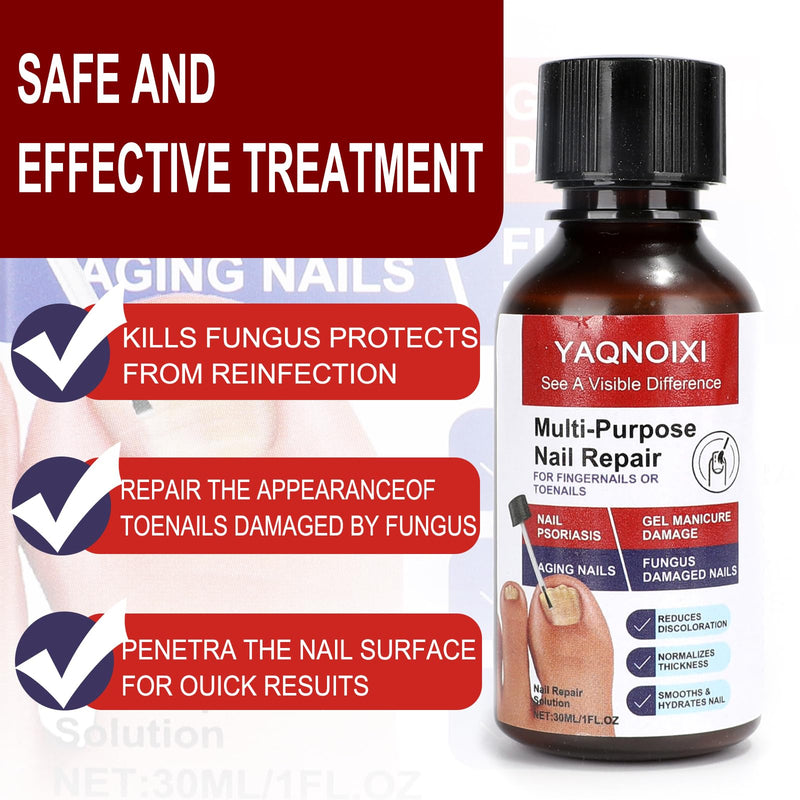 Toenail Fungus Treatment - Fast Acting For Thick, Discolored, Broken & Damaged Toe & Finger Nail, Treats Damaged Nails and Ingrown Toenails - 30ml/1oz (2pcs) 2pcs