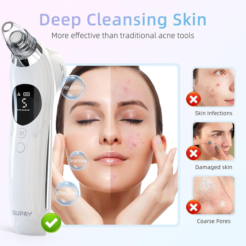 [Australia] - Blackhead Remover Vacuum Face Suction Pore Cleaner with Hot&Cold Compress Positive&Negative Ion Massage Nose Whitehead Remover Pimple Sucker with 5 Probes Pore Extractor Tool… (Black) Black 