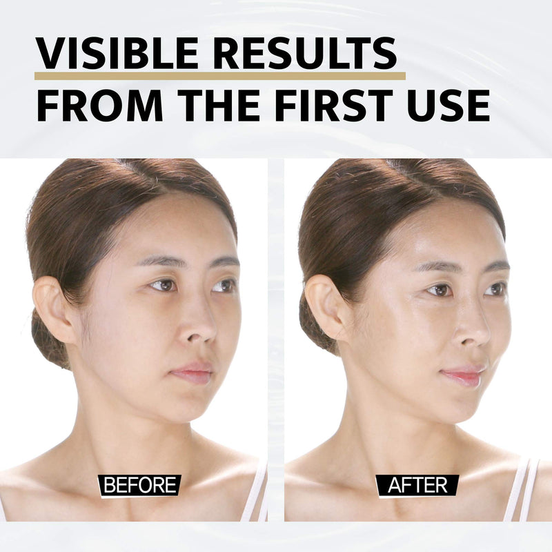 Silicone Skin Mask | Face Lifting Double Chin Reducer | V Line Lifting | Under Eye Mask | Forehead Wrinkles Treatment | Korean Skin Care 1 Count (Pack of 1)