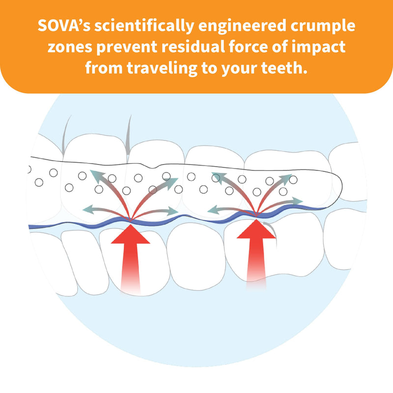 SOVA Junior Night Guard, Purple Punch - 1.6mm Thin - Custom-Molded Fit - Protects Against Nighttime Teeth Grinding & Clenching - FSA/HSA Eligible - Odor & Taste Free - Remoldable Up to 20 Times