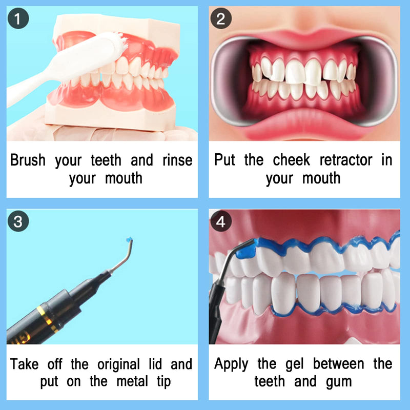 Dental Gingival Barrier Protection Gel, 10PCS 3ML Gum Protector Gel for Teeth Whitening