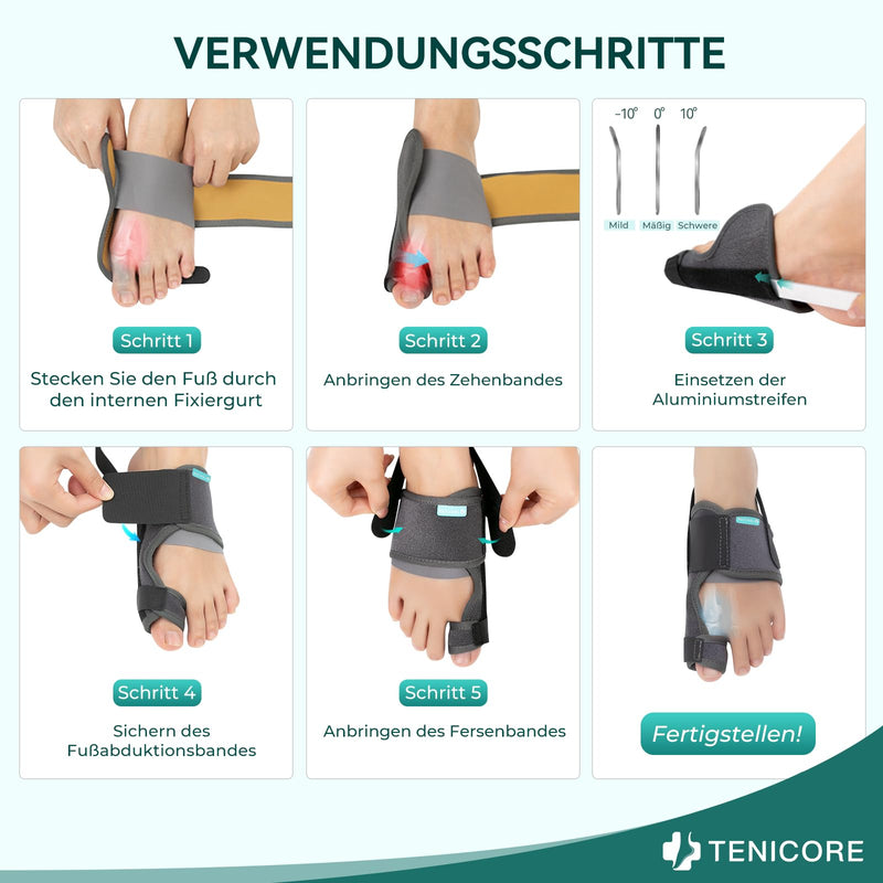 [Australia] - TENICORE Hallux Valgus Correction with 2 Angle Irons Hallux Valgus Splint Non-Slip Strap Bunion Toe Separator Toe Protector 1 Pair 