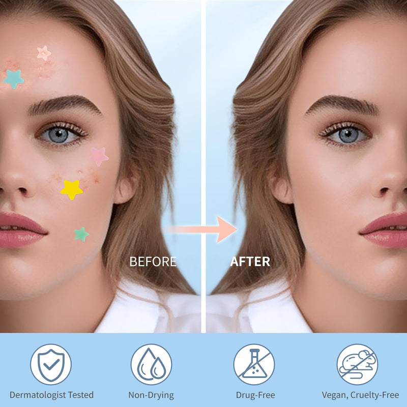 [Australia] - Pimple Patches for Face, Hydrocolloid Acne Patches, Cute Star Zit Covers, Colorful Spot Stickers with Tea Tree, Salicylic Acid & Cica Oil| 3 Sizes (10mm, 12mm & 14mm) |200 Count 50 Count (Pack of 4) 