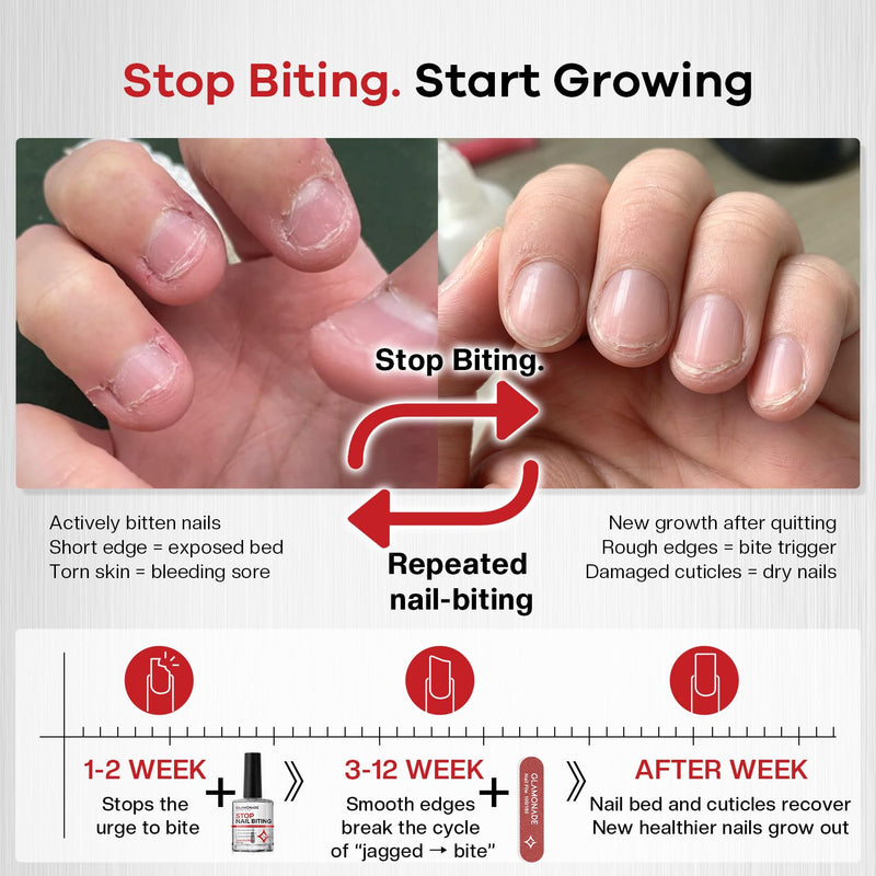 Glamonade 2-in-1 Stop Nail Biting Treatment Kit: Extra Bitter Polish to Deter Biting & Professional Nail File to Smooth Jagged Edges Complete Solution to Remove Biting Triggers for Kids & Adults | Gentle 100/180 Grit Erases Bite-Trigger Edges, 12ml Pla...