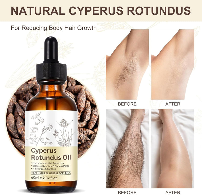[Australia] - Cyperus Rotundus Oil,Cyprus Rotundus Oil for Hair Removal,Cyperus Oi-l Natural, Soothing and Gentle,Reducing Body Hair Growth,Smooth Skin & Hair Removal,60ml (1pcs) 2.02 Fl Oz (Pack of 1) 
