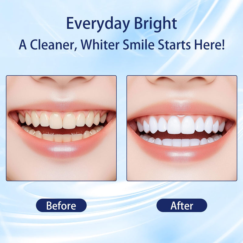 [Australia] - Teeth Whitening Strips 14 Treatments, Gentle Enamel-Friendly Formula for Sensitive Teeth with Non-Slip Dry Tech, for Brighter Smiles After Coffee/Wine, 28 White StripsÔºàMintÔºâ 
