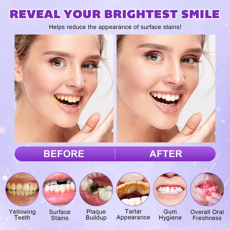 [Australia] - Teeth Whitening Powder - Snow Teeth Whitening Powder with Pap+ Formula, Peroxide-Free, No Sensitivity & Enamel Safe - Removes Coffee, Tea, Wine, Tobacco & Food Stains - 35g | 1.23oz 