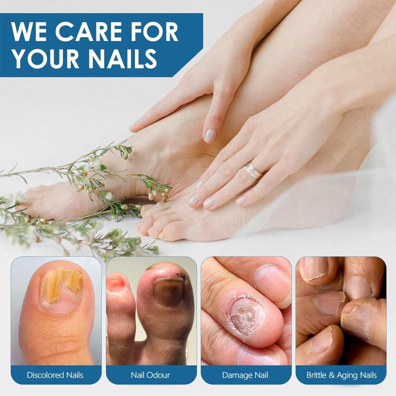 [Australia] - Toenail Fungus Treatment Extra Strength, Toe Fungus Treatment for Toenail, Toe Nail fungus Treatment Extra Strength, Nail Treatment, Safely and Gently 1 Fl Oz (Pack of 1) 1 Fl Oz (Pack of 1) 