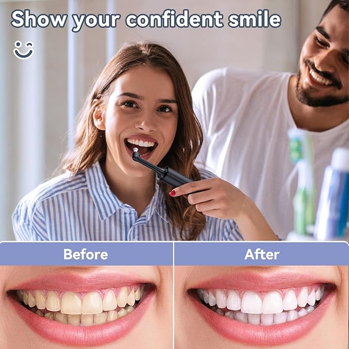 Teeth Polisher and Plaque Remover,Tooth Polishing Kit with 5 Replacement Heads & Cleaning Modes,USB Rechargeable,Ipx6 Waterproof,Teeth Polisher Electric Professional for Adults &Kids Blue