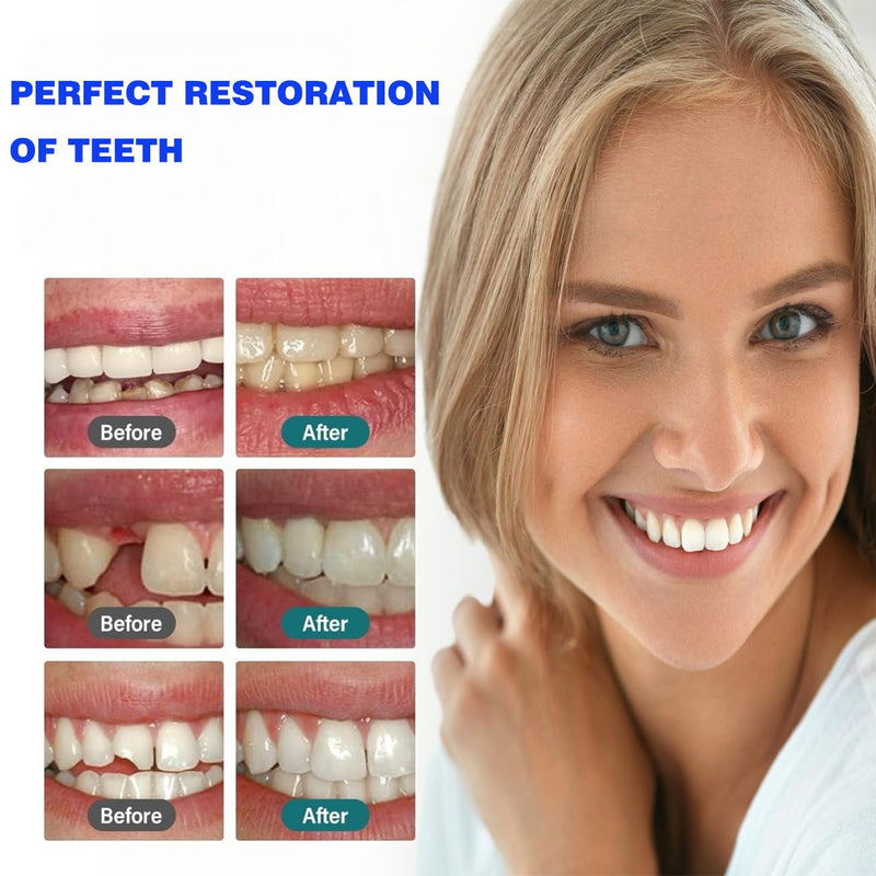 [Australia] - Tooth Repair Kit Zinc Oxide Eugenol Cement Dental Care Kit, Temporary Teeth Replacement, Dental Care Repair for Broken Chipped Teeth, Crown Fillings & Bridges 2PCS 2 