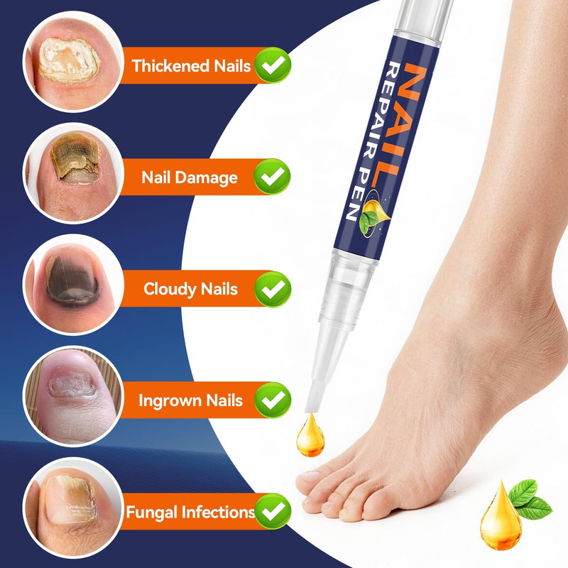 Toenail Fungus Pen, 25% Undecylenic Acid- Repairs Yellow Thick Brittle Toe and Fingernails - 5 Pens with 1 Nail Files
