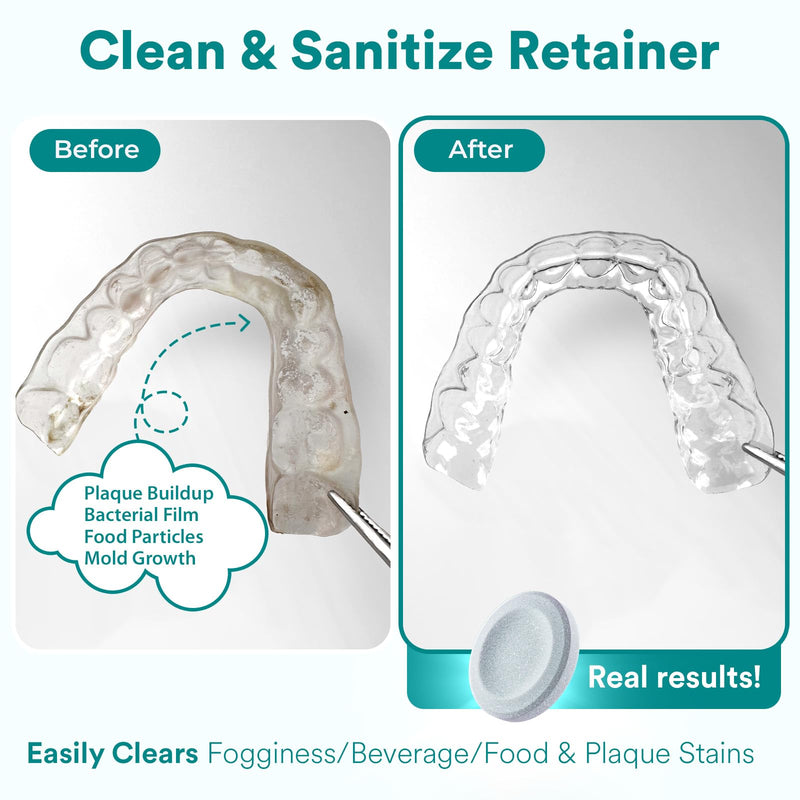 [Australia] - Weiss Naturals Retainer Cleaner Tablets, Invisalign Cleaner, Remove Stains, Odors & Plaque, PERSULFATE FREE Night Guard & Denture Cleaner 4-Month Supply, 120 Mint Scented Tablets 1 Count (Pack of 120) 