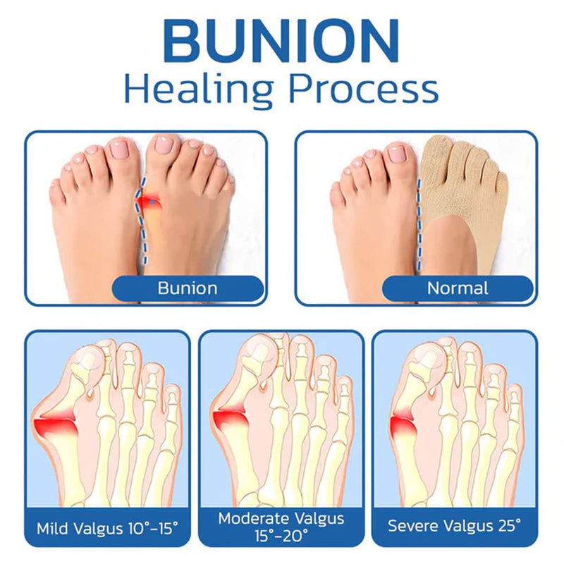 [Australia] - 5 Pairs Sock Align Toe Socks for Bunion, No Show Low Cut Five Finger Orthopedic Compression Socks For Women (Toe Socks-B) Toe Socks-B 