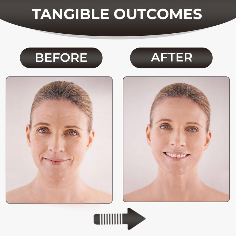 Silicone Face Tape | Anti-Wrinkle Face Tape | 2 Rolls with Different Widths for Custom Fit | Toning, Firming & Tightening Tape | Gentle on Sensitive Skin | Overnight Hold for Wrinkles and Fine Lines