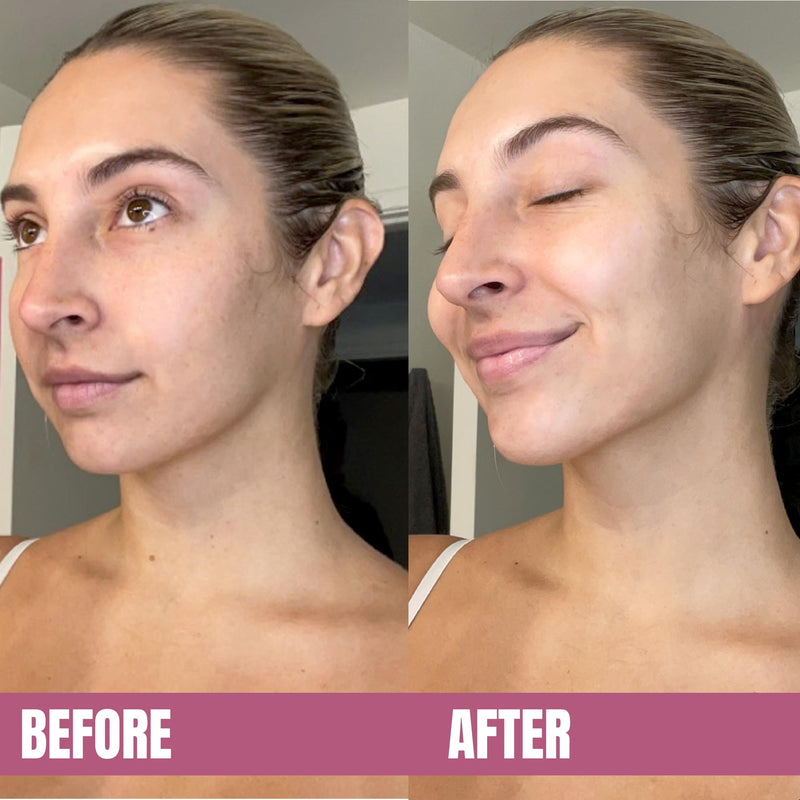 LAPCOS V-Line Contour Face Mask (5pk) | Chin Mask to Lift, Tighten Skin | Define Jawline | With Hydrating Vegan Collagen | Korean Beauty Favorite 5