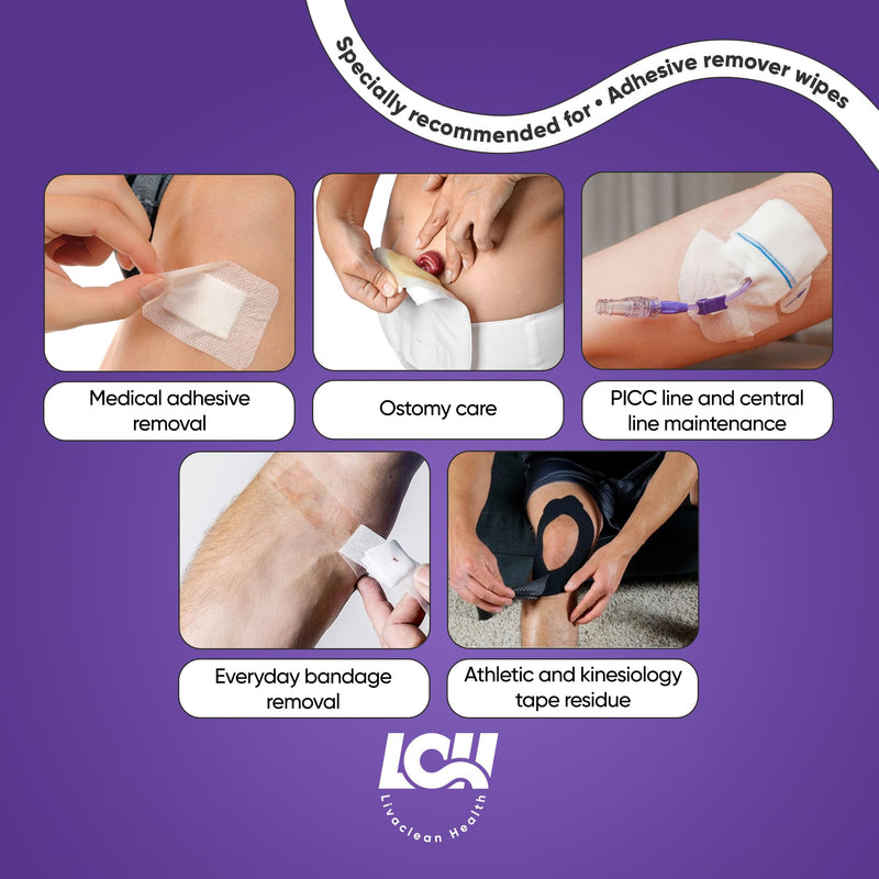 [Australia] - 100 CT Adhesive Remover Wipes ‚Äì Strong & Effective Skin Adhesive Remover ‚Äì 2 Ply 2.56x1.18in (6.5x3cm) ‚Äì Medical Adhesive Remover for Bandage, Tape, Dressings, and Ostomy Residue - By Livaclean Health 