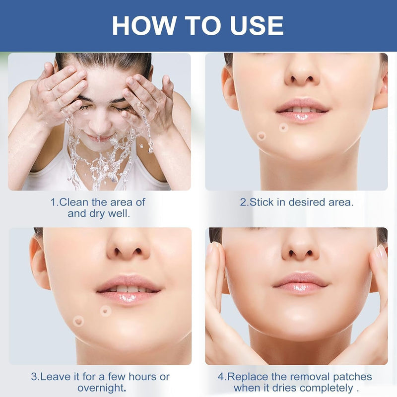 [Australia] - Wart Remover,Fast & Easy Operate Hydrocolloid Gel Waterproof Invisible Sticker,Suitable for All Skin,Friendly to New-User(144pcs)-G1 White 