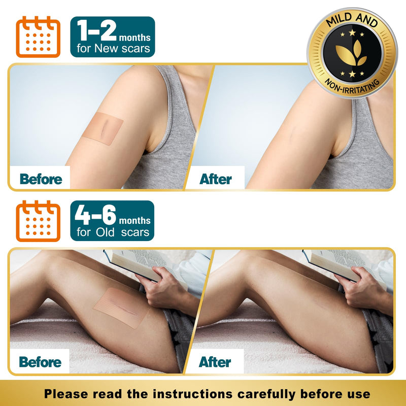 [Australia] - Arme Silicone Scar Tape, 1.6" x 240" Silicone Scar Sheets(2 Rolls-6M), Medical Grade Scar Tape Removal Sheets for Surgical Scars, Reusable Scar Removal Strips for Tummy Tuck C-Section Keloid 2 Pack 