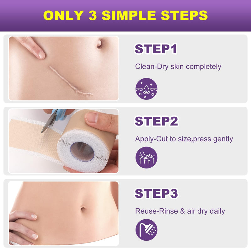 [Australia] - Silicone Scar Sheets, Silicone Scar Tape, Scar Tape for Keloid Bump Removal, Reusable Silicone Scar Strip for C-Section, Keloid, Surgery, Burns, Acne Scar et(1.6‚Äùx60‚ÄùRoll-1.5M) 1.5M (Pack of 1) 
