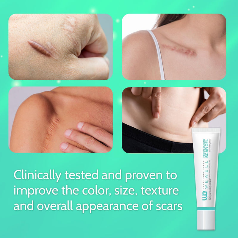 [Australia] - Scar Cream for Surgical Scars Removal: Advanced Silicone Scar Gel for Keloids, Acne, Stretch Marks, Pregnancy, C-Section & Burn Recovery ‚Äì Old & New Scar Treatment, 1 oz 1 Ounce (Pack of 1) 