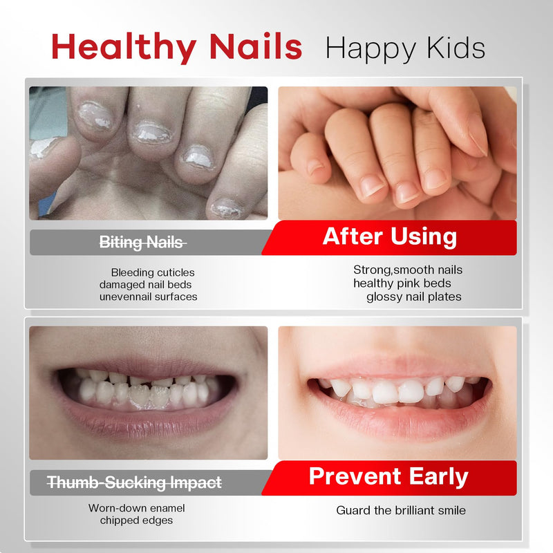 Glamonade 2-in-1 Stop Nail Biting Treatment Kit: Extra Bitter Polish to Deter Biting & Professional Nail File to Smooth Jagged Edges Complete Solution to Remove Biting Triggers for Kids & Adults | Gentle 100/180 Grit Erases Bite-Trigger Edges, 12ml Pla...