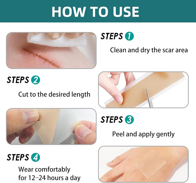 [Australia] - Silicone Scar Sheets, Silicone Scar Tape(1.6”x 60” Roll-1.5M), Silicone Scar Strips, Professional Scar Removal Sheets for Surgical Scars, Keloid, C-Section, Burn et 