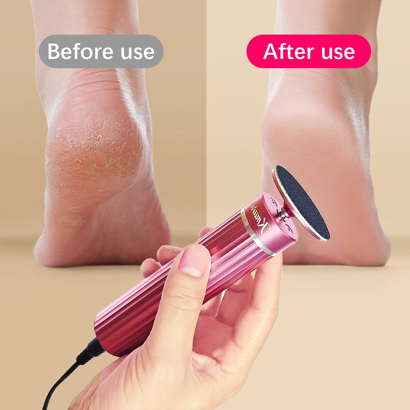 [Australia] - 5.3'' Electric Foot Callus Remover with 80pcs Sandpaper Discs & Brush, Professional Aluminum Ergonomic Pedicure Tool, Stepless Speed & Reverse Control for Dead Skin Removal (Pink) Pink 