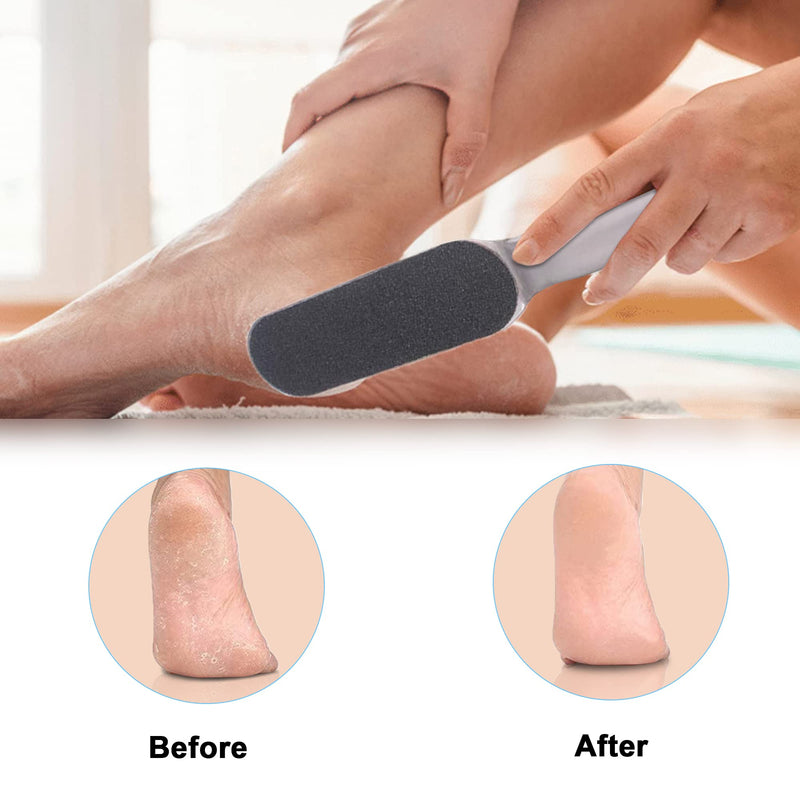 [Australia] - VENGABY callus remover and 20 replacement sandpaper, callus removal foot, callus plane, callus and callus file, callus rasp, foot care set, stainless steel handle, double-sided design 