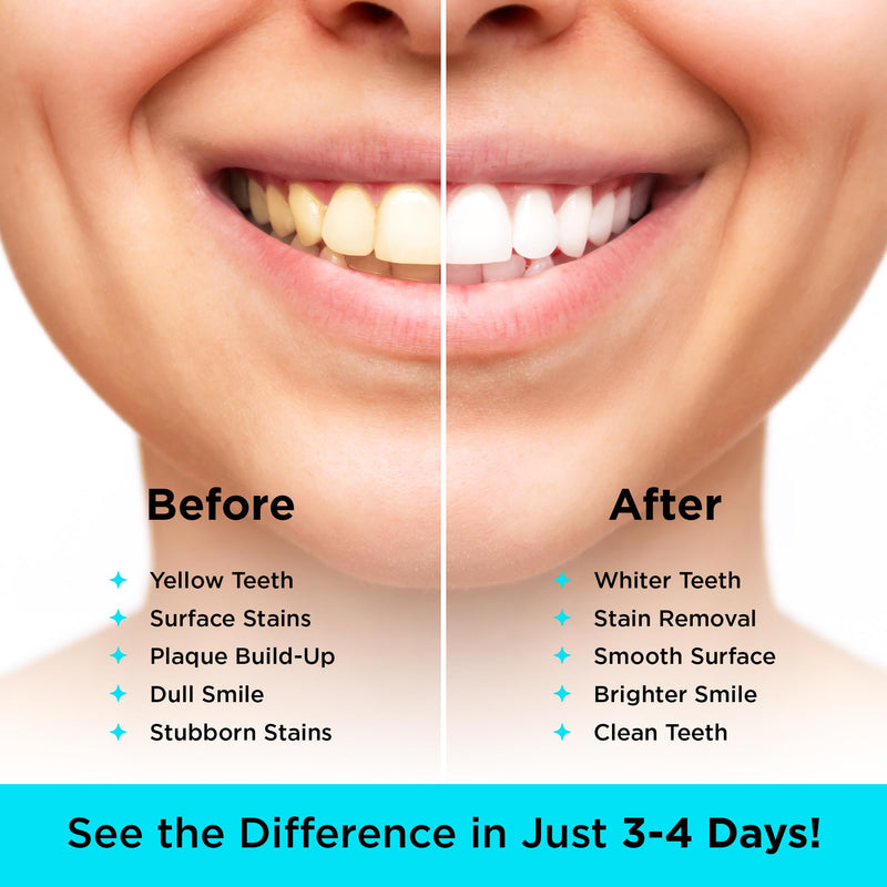 [Australia] - CARBON WHITE Teeth Whitening Powder - Natural Activated Coconut Charcoal Tooth Powder for Removing Stains & Discoloration - Helps Fight Tartar & Plaque, Freshens Breath - Tasteless, Odorless - 30g 