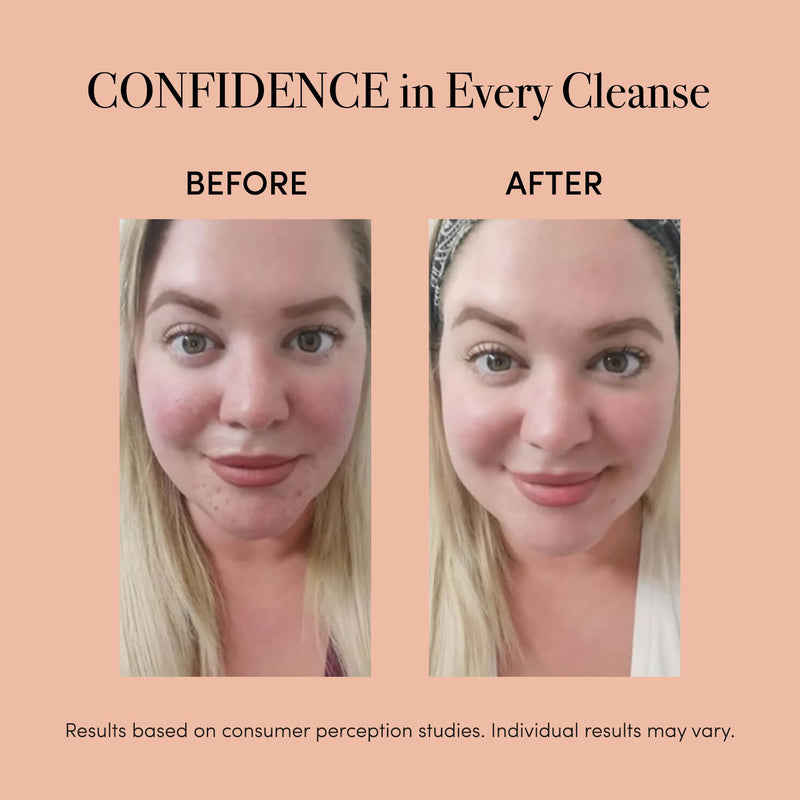 reVive Light Therapy Lux Collection Spot Acne Device, Portable Red & Blue Light LED Therapy Products for Blemish-Prone Skin, Rechargeable, On-The-Go Face Tools for Skincare White