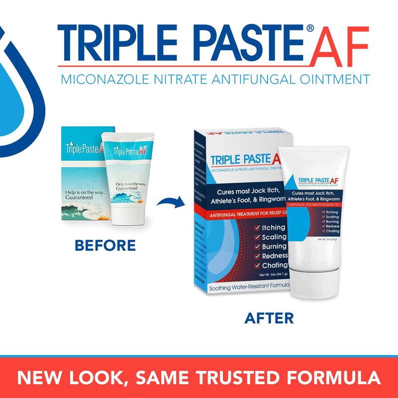 Triple Paste AF Antifungal Ointment, 2% Miconazole Cream, 2 oz | 2% miconazole antifungal ointment helps treat athlete's foot and ringworm; skin antifungal cream in 2 oz tube. 2 Ounce (Pack of 1)