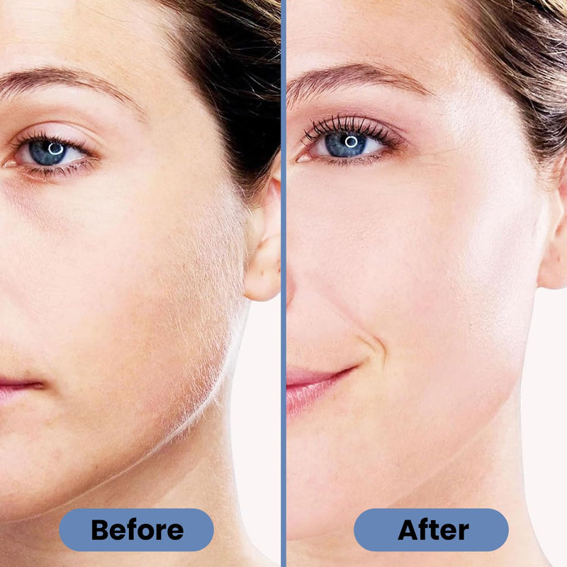 Facial Hair Remover for Women – Electric Face Razor with Light, Hair Removal for Upper Lip, Chin & Cheeks – Color Blue