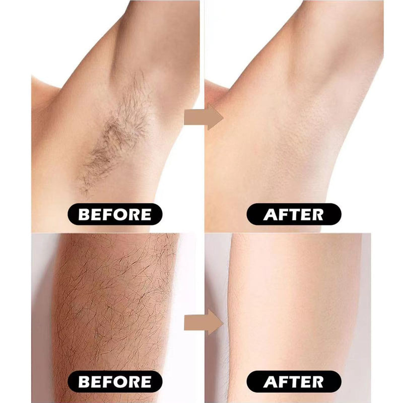[Australia] - Razors for Women Sensitive Skin，6 blade Lady Shaving Razor for Women, Women’s razors for Shaving Including 1 Travel Razors for Women with 19 Blade Refills 