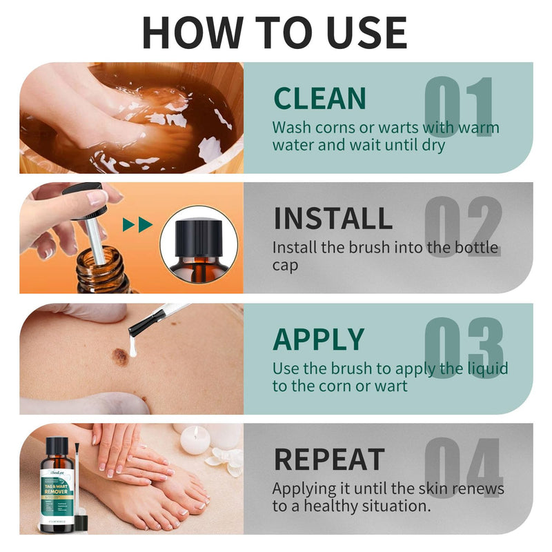 [Australia] - Wart Remover Liquid - 12% Wart Liquid with Salicylic Acid - Fast Acting Wart Freeze OffÔºåfor Warts, Plantar Wart, Genital Wart White 