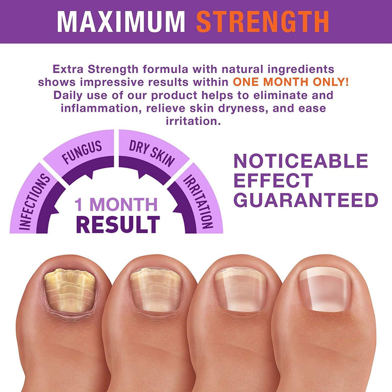 [Australia] - Toenail Fungus Treatment Extra Strength for Toenails and Fingernail Discoloration 1.0 Oz Drop 1 Fl Oz (Pack of 1) 