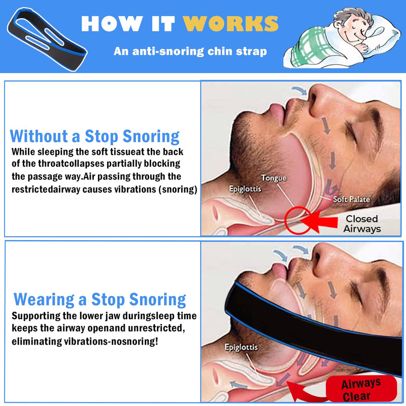 [Australia] - Anti Snoring Chin Strap Effective Stop Chin Strap for Men Women, Anti Snoring Devices for Sleep Adjustable and Breathable Anti Snore Devices Snoring Reduction Stop Snoring Aids for Better Sleep (Blue) 