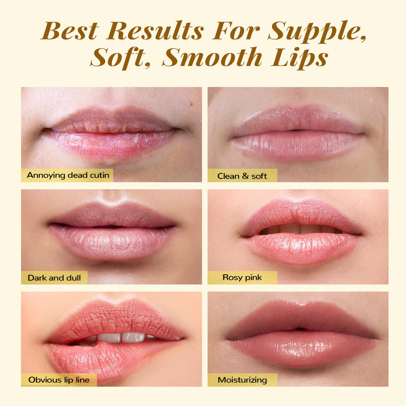 [Australia] - ANAI RUI Lip Care Kit - Lip Sugar Scrub Set, Lip Sleeping Mask & Lip Exfoliator Scrub - Overnight Lip Skin Treatment - Scrub & Moisturizer for Dry Chapped Cracked Peel Lips (Turmeric+Honey) 