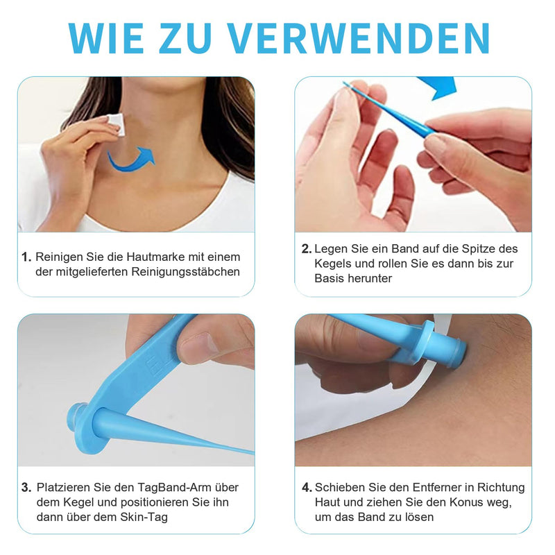[Australia] - Stalk wart remover, 3-in-1 stalk wart remover, fibroma remover, skin tag remover kit, physical removal of skin tags, quick, safe, pain-free stalk wart removal device 