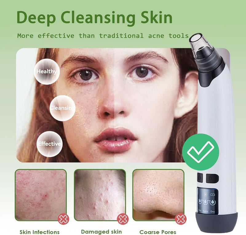 Blackhead Remover Pore Vacuum - Facial Pore Cleaner with 3 Adjustable Suction Levels, 4 Blackhead Removal Tools, Electric Acne Extractor Tool for Women & Men White