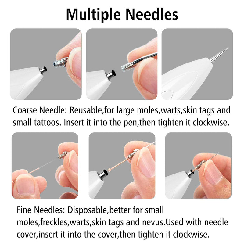 [Australia] - Mole Removal - VOONEEN Mole Removal Professional Beauty Pen, with 9 Strength Levels for Face and Body, Removal of Warts, Nevus, Birthmarks, with USB Rechargeable (White) White 