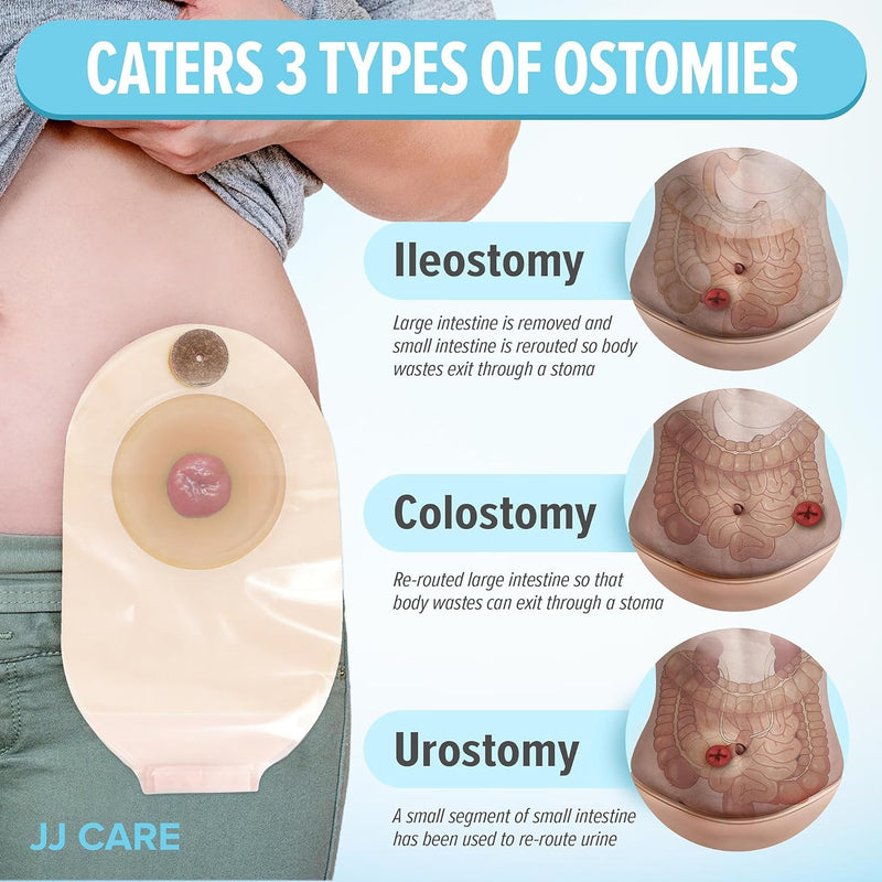 [Australia] - JJ CARE Colostomy Bags 20 PCS, One-Piece Pouching Ostomy Bags, No Mess Ostomy Supplies for Ileostomy, Colostomy, Urostomy Stoma Care with Odor Barrier, Drainable Ostomy Pouch with Cut to Fit Closure 