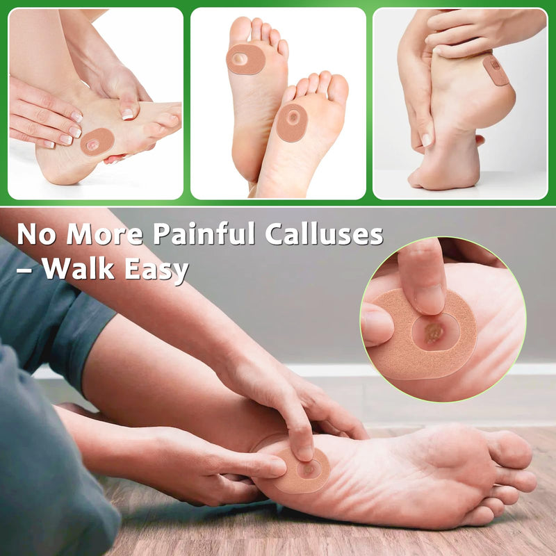 [Australia] - 51 Pcs Callus Pads Soft Thick Oval Shape Corn Pads, Felt Callus Cushions Adhesive Corn Protectors for Men Women Oval Shape Design, Reduce Pressure and Friction from Shoes Rubbing 0.17 IN-51Pcs Nude 