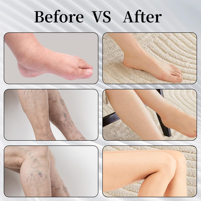 [Australia] - 20-30mmHg Thigh High Compression Stockings, Silicone Dot Band Anti-Slip Compression Socks for Women & Men, Medical Compression Socks for Nurses,Pregnant,Varicose Veins, Sports Recovery Medium Multi-Open Toe*2 