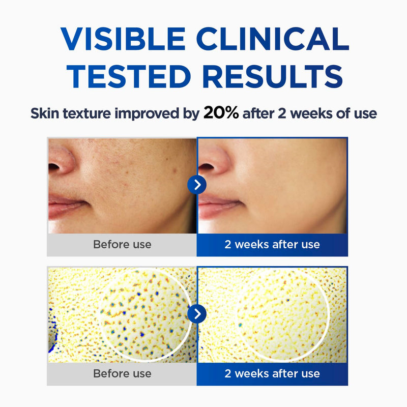 CKD Vita C TECA Toning Shot Serum – Vitamin C & TECA Face Serum for Brighter-Looking Skin, Hydrating Facial Serum for Radiant Complexion, Korean Skincare, 1.01 fl oz 1.01 Fl Oz (Pack of 1)