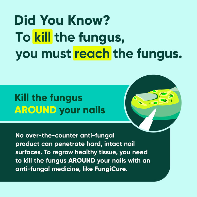 FUNGICURE Medicated Liquid Gel - Maximum Strength 0.35 Fluid Ounce | Cures fungal infections & kills 6 types of fungus. Clinically proven clotrimazole 1%. Easy, precise, no-mess application.