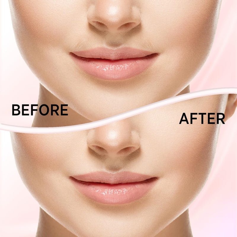 Facial Hair Removal for Women: Electric Face Razor with LED Light - Painless & Instant Results Mini Shaver for Travel Use (Rose Gold) Rose Gold