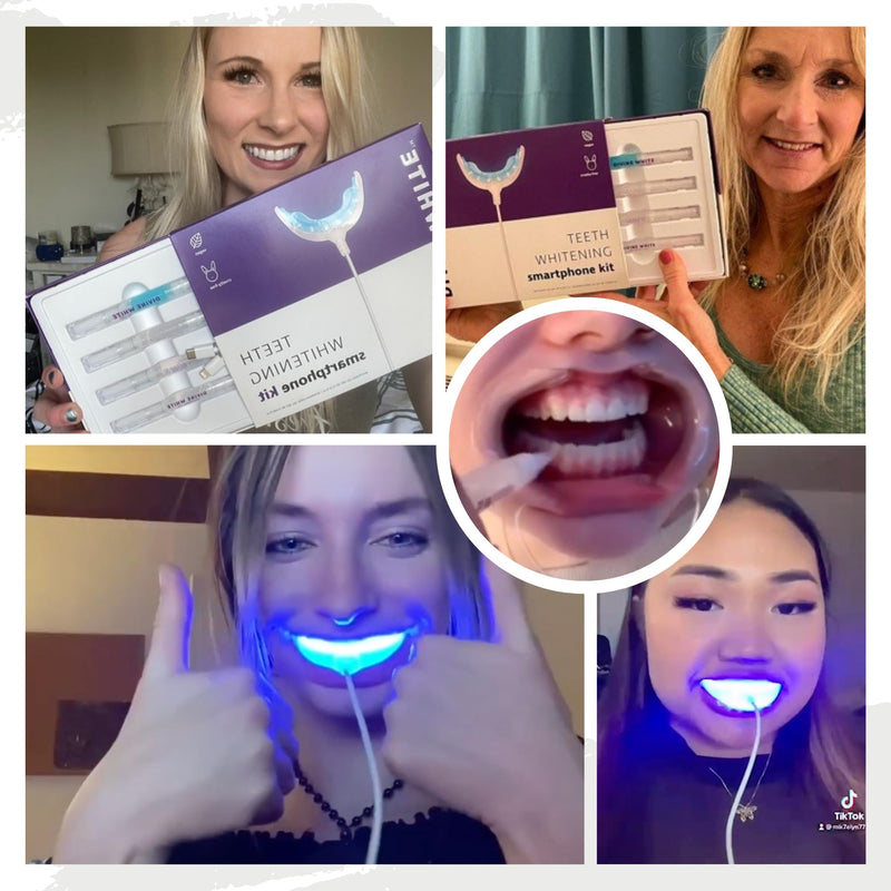 [Australia] - Professional Teeth Whitening Kit, LED Accelerator Light, 36% Carbamide Peroxide Teeth Whitening Gel, 20 Whitening Treatments, Remineralizing Gel, USA-Made Gels 