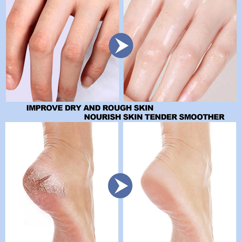 [Australia] - Crack Feet Prevention Stick, Anti Crack Foot Cream Stick, Foot Care Cream Cracked Feet, Moisturizing Foot Balm, Softening and Nourishing Cream for For Dry Heels 2 